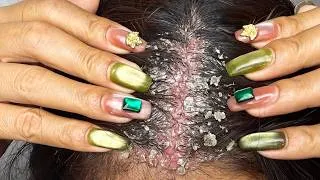 Thumbnail: ASMR Soothing Scalp Scratching & Massage #DKMO38007