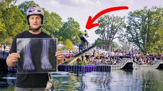 Thumbnail: I TRIED THIS CHALLENGE AND BROKE MY LEGS!!