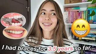 Thumbnail: BRACES UPDATE after 3.5 YEARS | why is it taking so long?