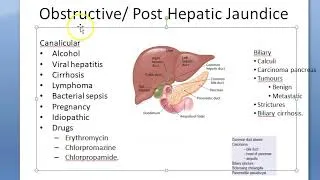 Thumbnail: Medicine Obstructive Jaundice Causes Post Hepatic Reasons Biliary Gall bladder PYQ