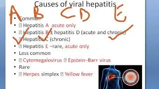Thumbnail: Medicine Acute Viral Hepatitis Causes Virus PYQ