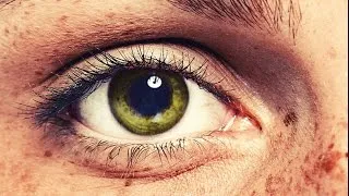 Thumbnail: "Melanoma: It Started with a Freckle" book trailer