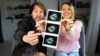 Thumbnail: WE'RE HAVING A BABY!
