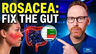 Thumbnail: Rosacea Won't Go Away? Your Digestion Might Be the Problem