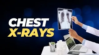Thumbnail: Chest X-rays Atlas