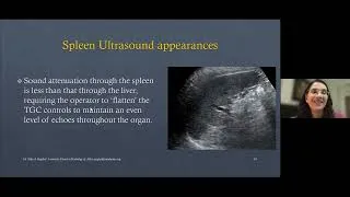 Thumbnail: Ultrasound Spleen with Dr. Alka Singhal | Medality / MRI Online Radiology Course