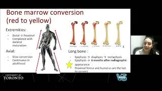 Thumbnail: Normal and Abnormal MRI Appearance of the Pediatric Bone Marrow | Dr. Alejandra Bedoya