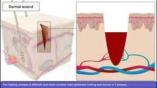 Thumbnail: Skin Wound Healing Process