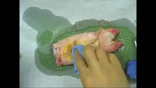 Thumbnail: Debridement of dirty wound tutorial