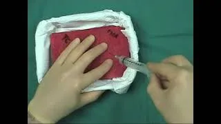 Thumbnail: Fine needle aspiration tutorial