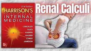 Thumbnail: NEPHROLITHIASIS | Risk Factors | Clinical Features | Management | Harrison
