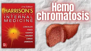 Thumbnail: HEMOCHROMATOSIS | Pathophysiology | Clinical Features | Diagnosis | Management | Harrison
