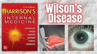 Thumbnail: WILSON'S DISEASE | Pathophysiology | Clinical Manifestations | Management | Harrison