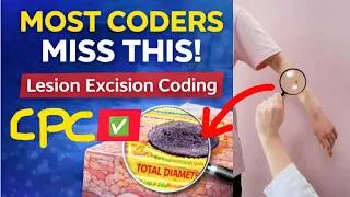 Thumbnail: Most Coders Get This Wrong! Lesion Excision Coding for CPC Exam