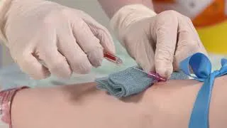 Thumbnail: Basic Clinical Skills: Cannulation