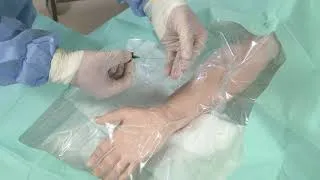 Thumbnail: Advanced Clinical Skills: Arterial Line Insertion