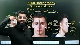 Thumbnail: Skull Surface Landmark and Lines || Part -1 || Radiographic Technique || Radiography Made Easy ||