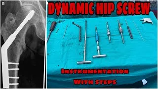 Thumbnail: Dynamic Hip Screw Instrumentation || DHS 