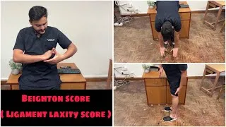 Thumbnail: BEIGHTON SCORE || Ligament Laxity Scoring 