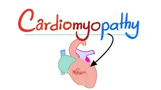 Thumbnail: All Cardiomyopathy Types - Dilated, Hypertrophic (HOCM), Restrictive, Takotsubu Cardiomyopathy 