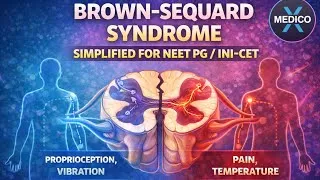 Thumbnail: Brown Sequard Syndrome simplified for exam only - efficient way to get answer | NEETPG & INICET