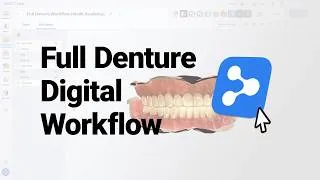 Thumbnail: Full Denture Digital Workflow