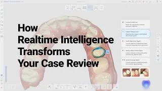 Thumbnail: How Realtime Intelligence Transforms Your Case Review