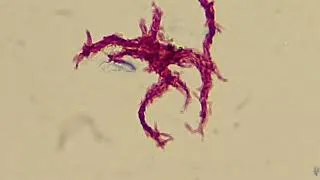 Thumbnail: Chord factor of Mycobacterium tuberculosis