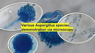 Thumbnail: Various Aspergillus species demonstration via microscopy