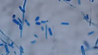 Thumbnail: Trichosporon in LPCB tease mount of culture