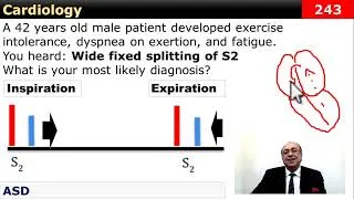 Thumbnail: Cardiology (Quiz Review) [243]   #CME #Internal_Medicine #USMLE