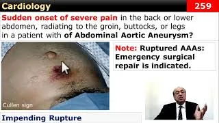 Thumbnail: #internal_medicine #cme #usmle #محاضرات_باطنة #ecg #كورسات_باطنة #clinical #clinical #medicine