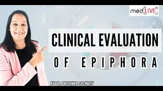 Thumbnail: Clinical Evaluation of Epiphora: Jones Test & Syringing | Ophthalmology Lecture
