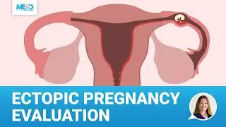 Thumbnail: Diagnosing Ectopic Pregnancy: Abdominal Pain in Early Pregnancy | Early Pregnancy Ultrasound