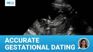 Thumbnail: Early Pregnancy Ultrasound: Assessment of Gestational Age | Crown-Rump Length & Biparietal Diameter