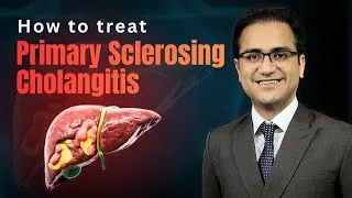 Thumbnail: Primary sclerosing cholangitis Treatment, Symptoms, Pathology, Diagnosis Medicine lecture USMLE