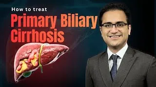 Thumbnail: Primary Biliary Cirrhosis (PBC) Treatment, Symptoms, Causes, Medicine Lecture USMLE, NeetPG