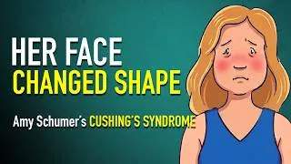 Thumbnail: Amy Schumer's Post-Surgery Treatment Changed Her Face