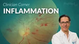 Thumbnail: Retinal Vasculitis Through a Surgeon's Eyes - What We Actually See in the Clinic