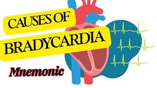 Thumbnail: Causes Of BRADYCARDIA(Slow Heart Rate): An Easy Mnemonic 