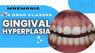 Thumbnail: Drugs Causing Gingival Hyperplasia (Gum Overgrowth) Mnemonic