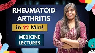 Thumbnail: Rheumatoid arthritis - Diagnostic criteria, complications, treatment | Medicine notes and lectures