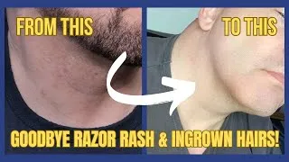 Thumbnail: Say Goodbye to Razor Burn: Best Post Shave Products Revealed