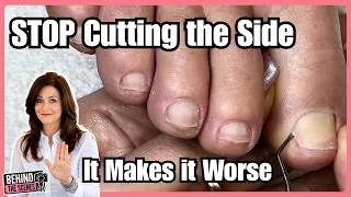 Thumbnail: Ingrown Toenail Pain? She Thought She Needed Surgery… But This Was Hiding Inside
