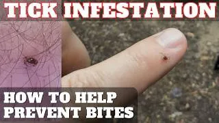 Thumbnail: TICKS INFEST GEORGIA STATE PARKS How To Prevent Tick Bites On Backpacking Trips