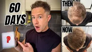 Thumbnail: I Was Losing My Hair...Until I Tried This