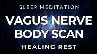Thumbnail: Guided Sleep Meditation: Vagus Nerve Body Scan for Deep Healing Rest (Very Strong)