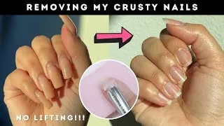 Thumbnail: How to remove 5 week old Gel X Nails at home 😳 *cheap & easy removal*