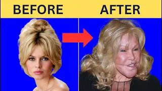 Thumbnail: Celebrity Plastic Surgery Disasters | Before and After