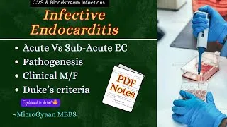 Thumbnail: Infective Endocarditis | Pathogenesis, Causes, Duke Criteria & Lab Diagnosis | MBBS Microbiology
